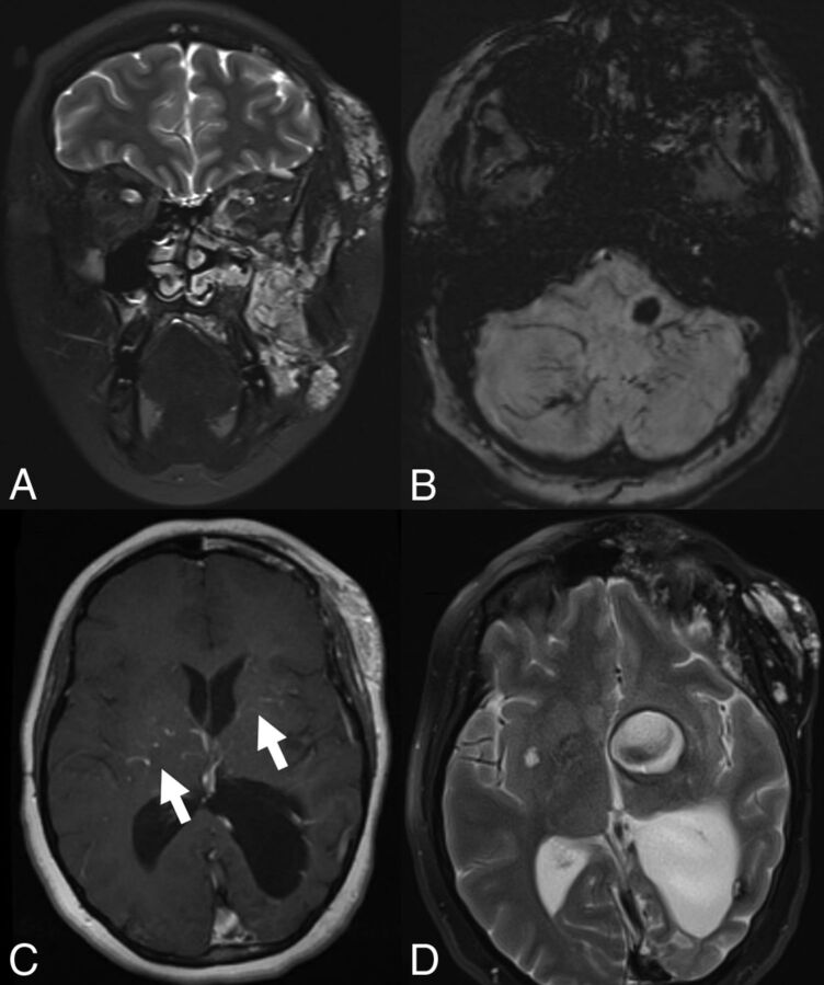 Fig 3.