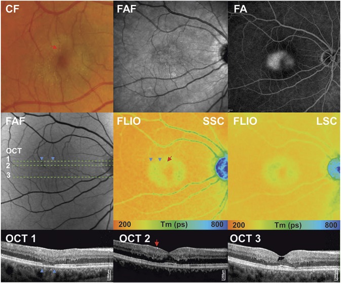 Fig. 3.