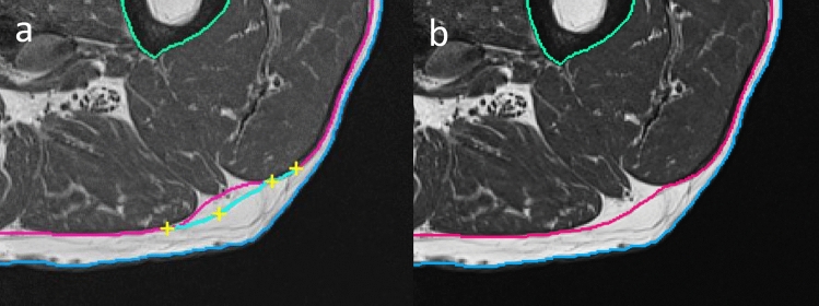 Fig. 4