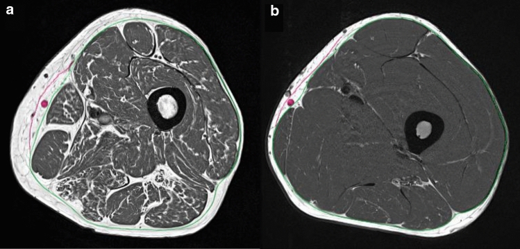 Fig. 1