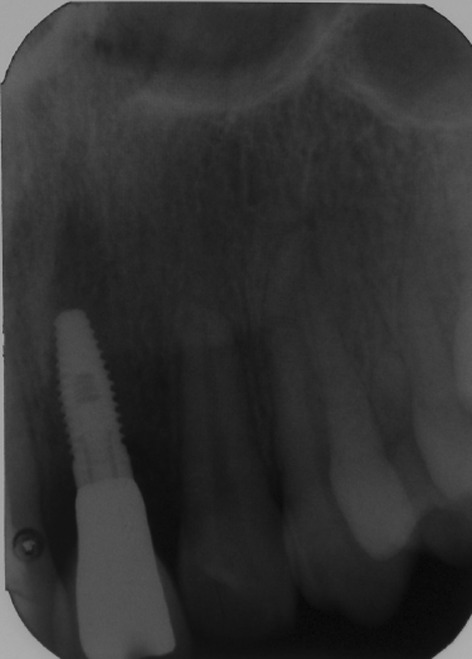 Fig. 5