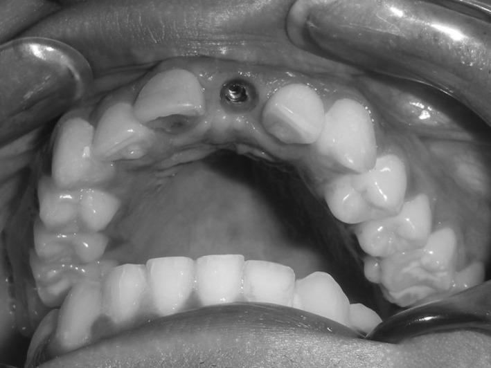 Fig. 3