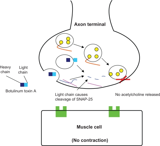 Figure 1b