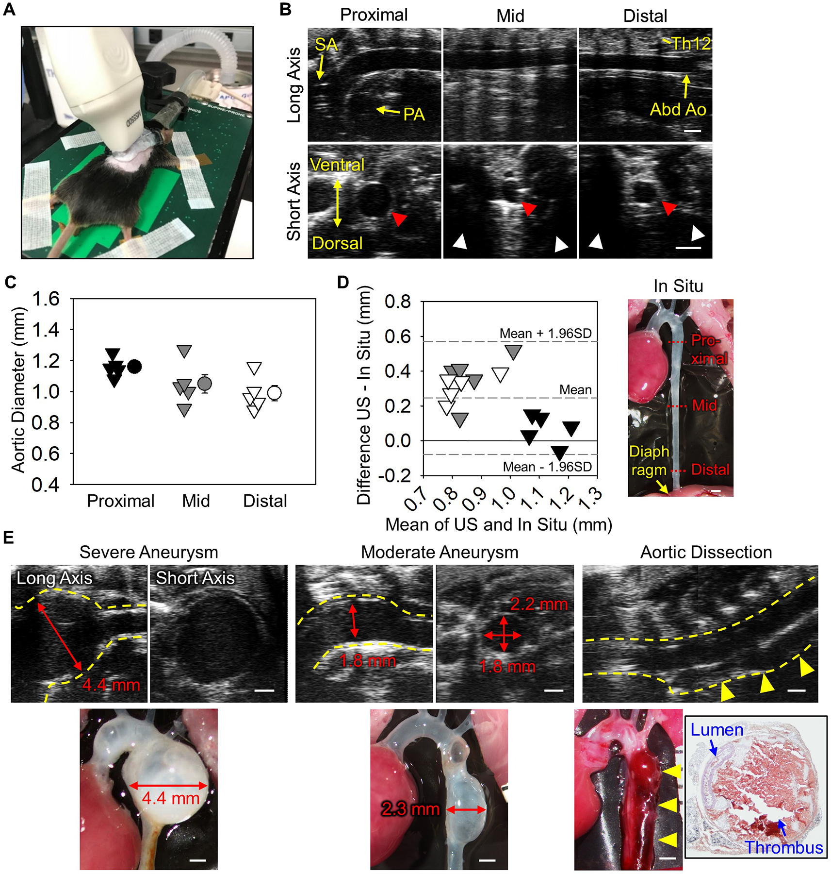 Ultrasound in vivo monitoring of the descending aorta in mice.