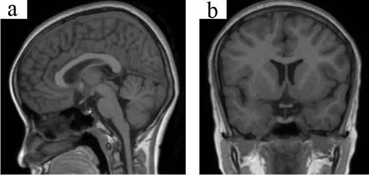 [Table/Fig-3a,b]: