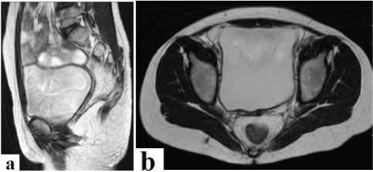 [Table/Fig-1a,b]: