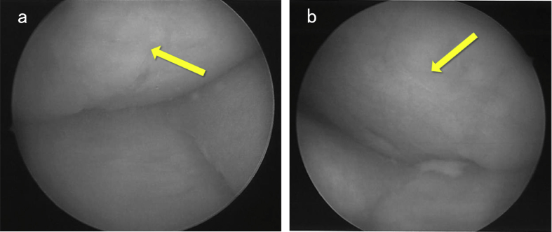 Fig. 4