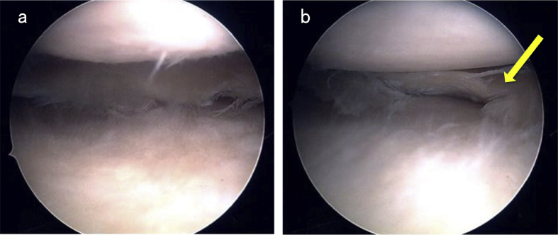 Fig. 6