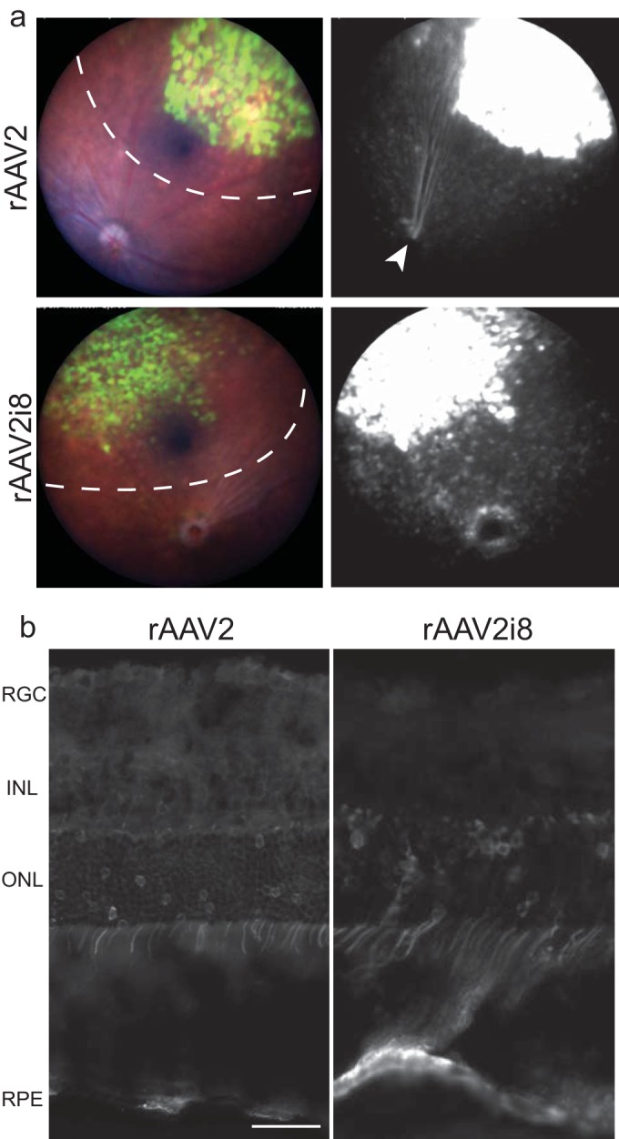 FIG 1