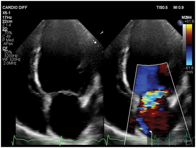 Figure 2: