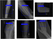 Fig. 20