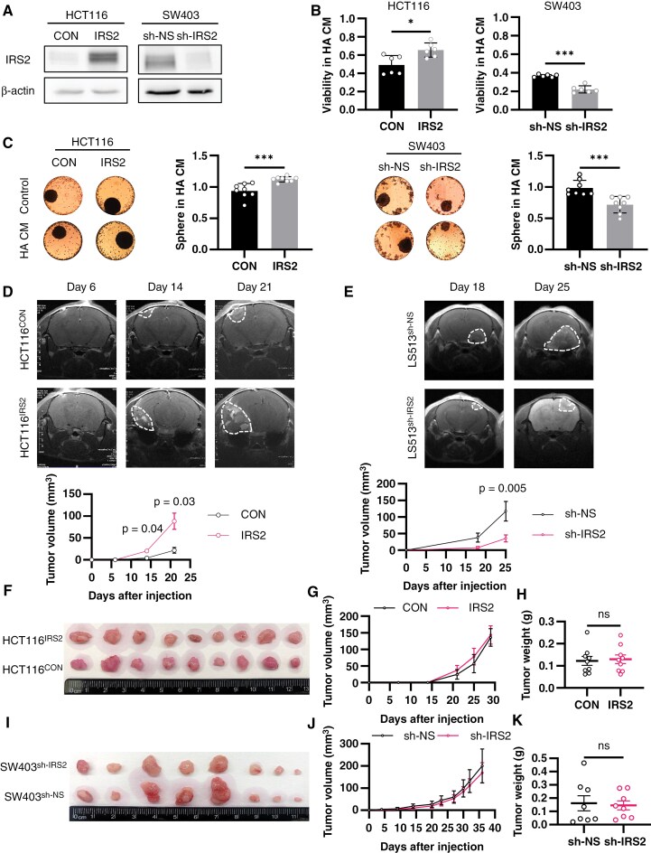 Figure 2 illustrates the role of IRS2 in enhancing colorectal cancer (CRC) tumorigenicity in the brain environment. (A) Western blot showing IRS2 protein levels in HCT116 cells with IRS2 overexpression and SW403 cells with IRS2 silencing, normalized to β-actin. (B) Bar graph comparing cell viability in HA-conditioned medium (HA CM) and control medium (HA SFM) using the inSphero assay. (C) Representative images of CRC spheres in HA CM and HA SFM, with a bar graph quantifying viability. (D) MRI images of mouse brains at days 6, 14, and 21 post-intracranial implantation of HCT116 control or IRS2-overexpressing cells, with quantified tumor volumes. (E) MRI images of mouse brains at days 18 and 25 post-intracranial implantation of LS513 control or IRS2-silenced cells, with quantified tumor volumes. (F) Gross images of subcutaneous tumors from HCT116 control and IRS2-overexpressing cells. (G) Tumor growth curve over time measured via calipers, displayed as a line graph. (H) Scatter plot of tumor weights at resection, showing individual data points. (I) Gross images of subcutaneous tumors from SW403 control and IRS2-silenced cells. (J) Tumor growth curve over time measured via calipers, displayed as a line graph. (K) Scatter plot of tumor weights at resection, showing individual data points.