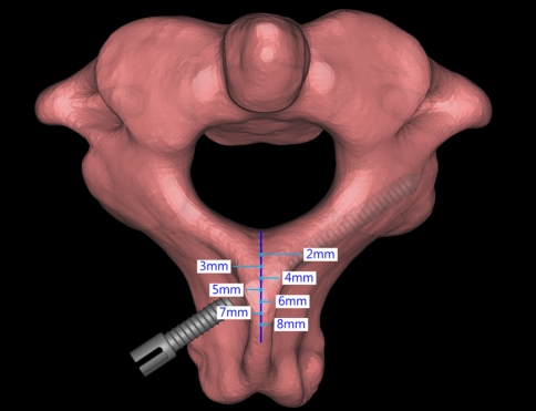 Fig. 1