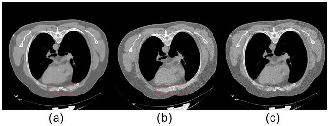 Fig. 10