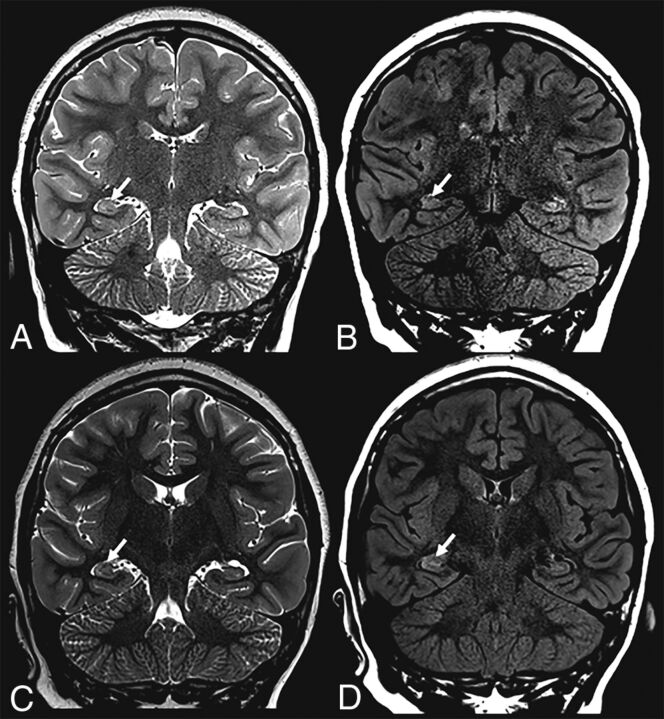 FIG 2.