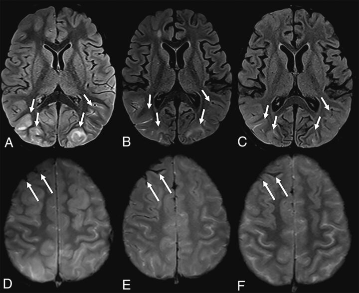 FIG 1.