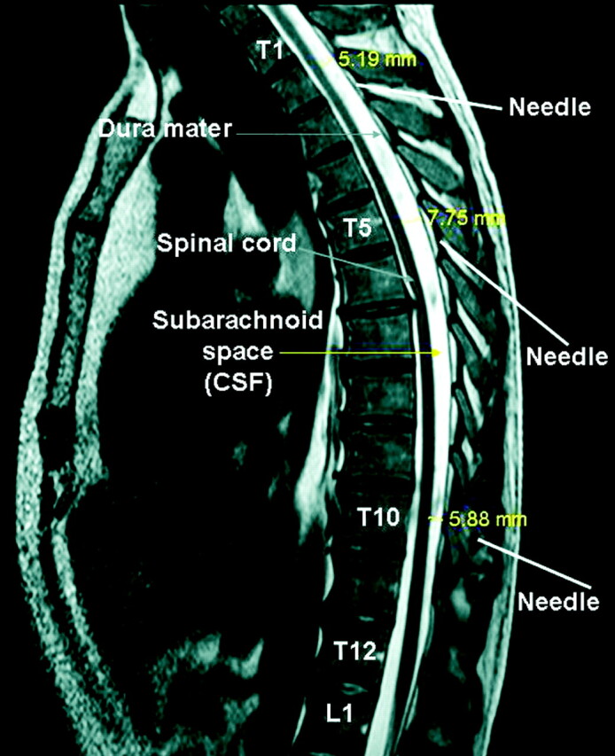 Fig 1.