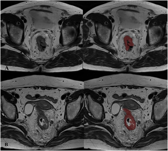 Figure 2