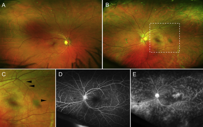 Fig. 1