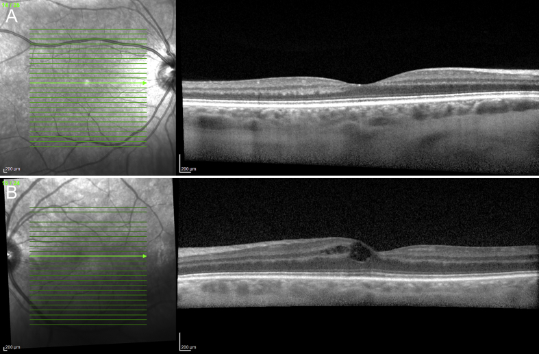 Fig. 2