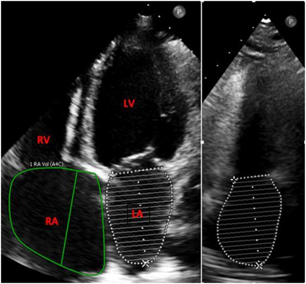 Fig.1