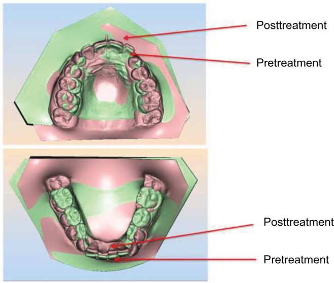 Figure 12