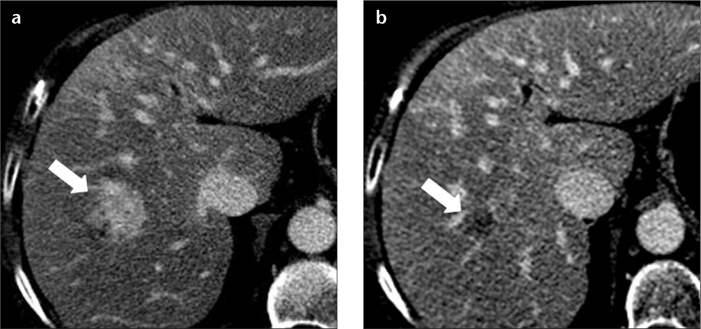 Figure 3. a, b.