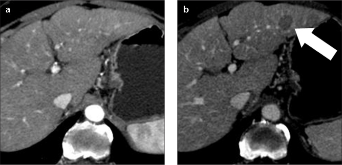 Figure 4. a, b.