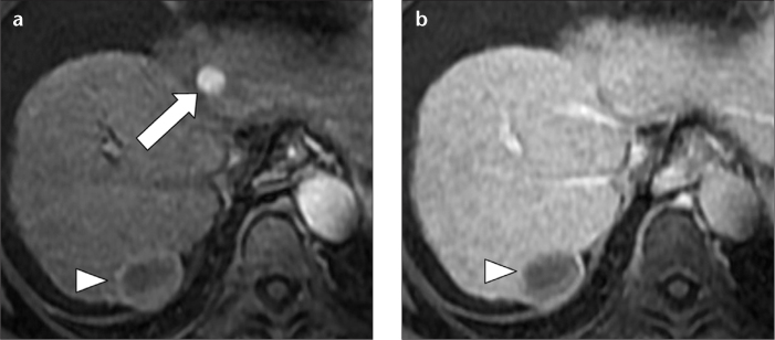 Figure 2. a, b.