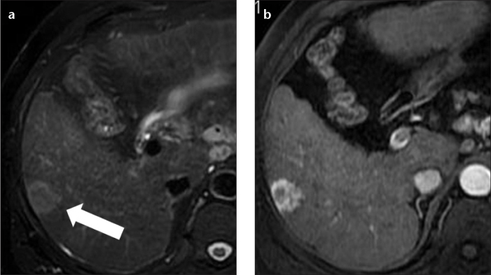 Figure 11. a, b.