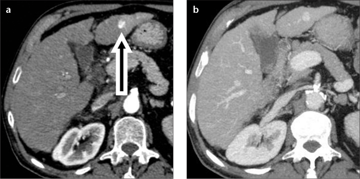 Figure 1. a, b.