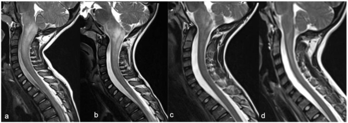 Figure 18