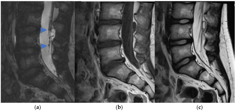 Figure 14