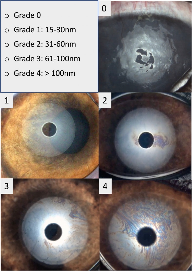 Fig. 4