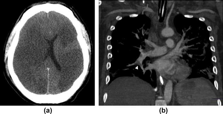 Figure 6