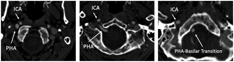 Fig 2