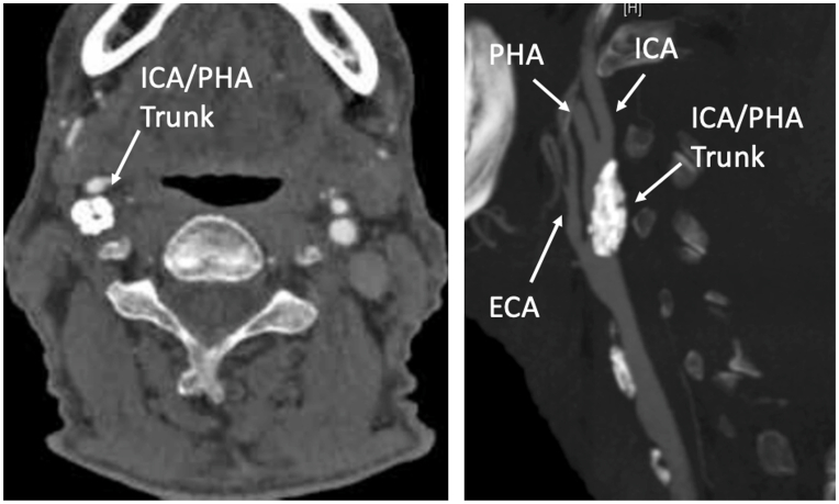 Fig 3