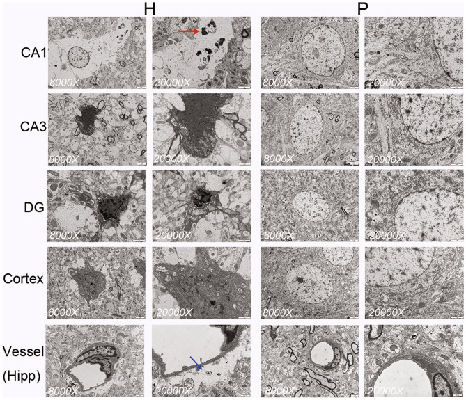 Fig. 12