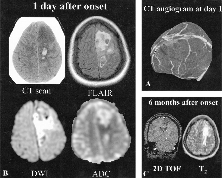 fig 3.