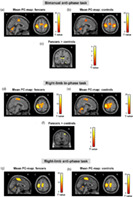 graphic file with name HBM-43-3375-g001.jpg
