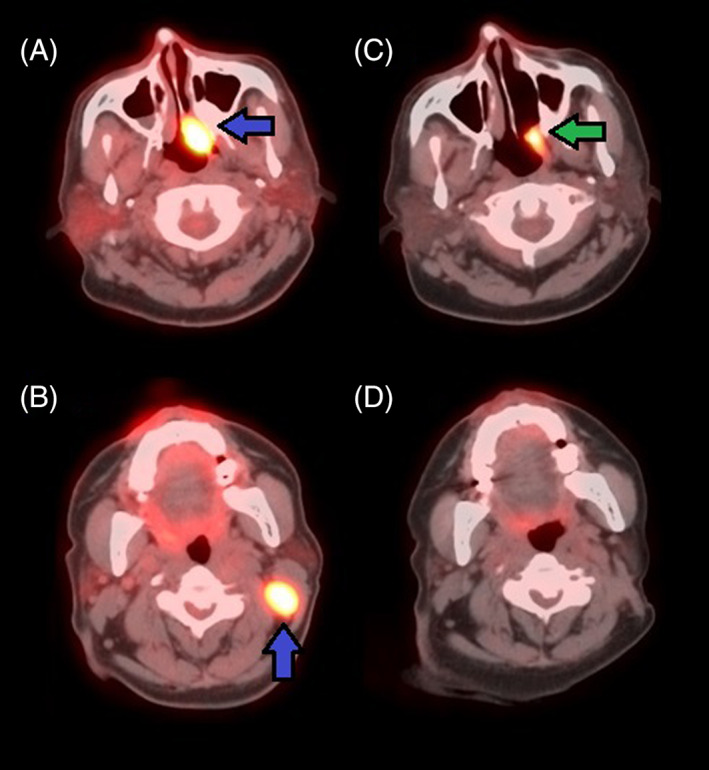FIGURE 2