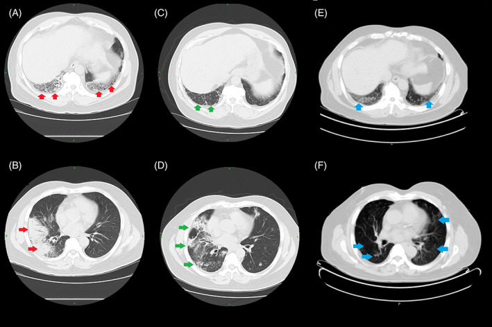 FIGURE 3