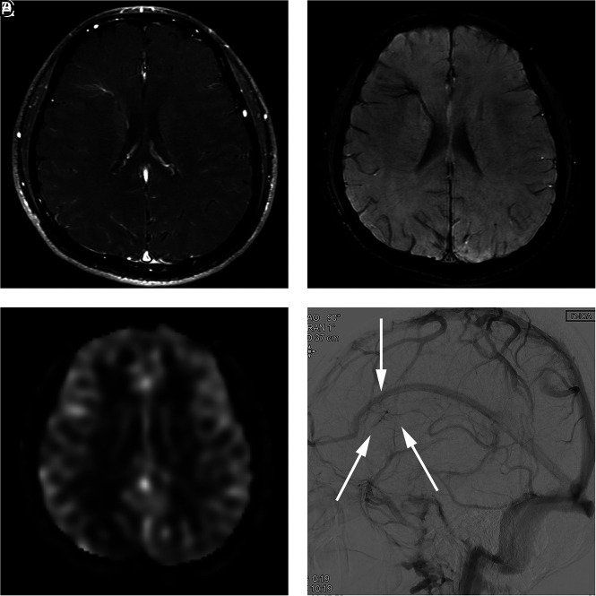 FIG 3.