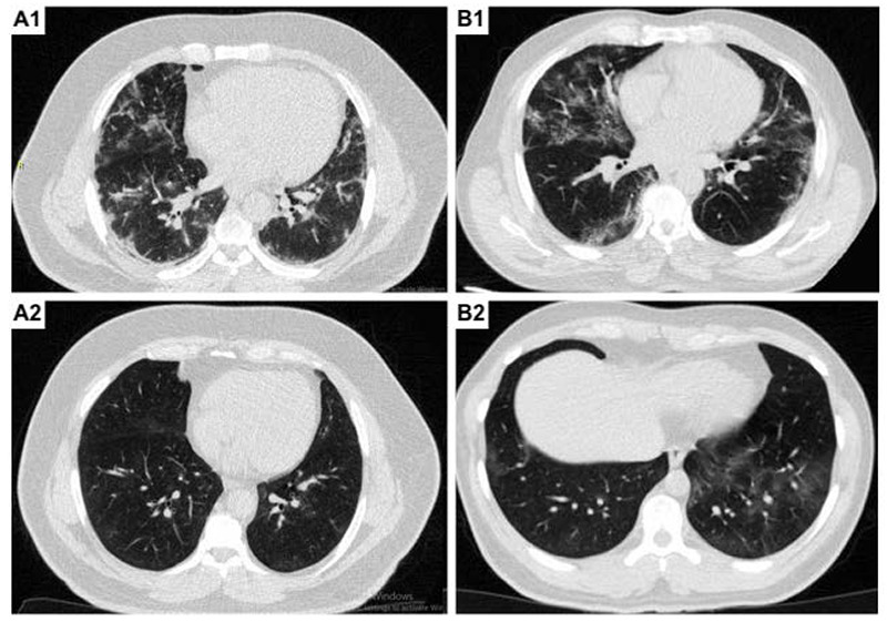 Fig 1.