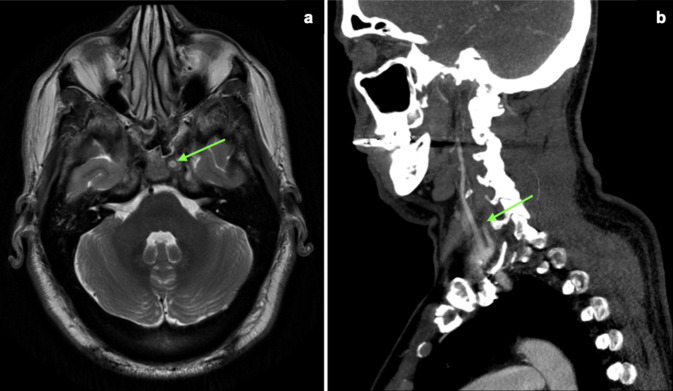 Fig. 1