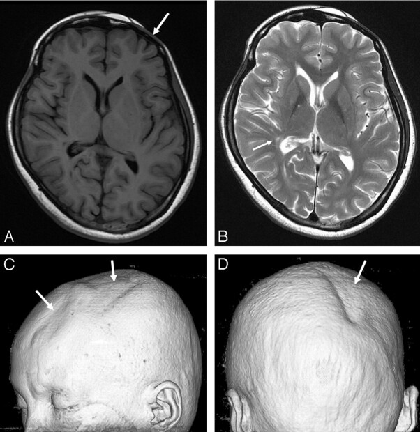 Fig 1.