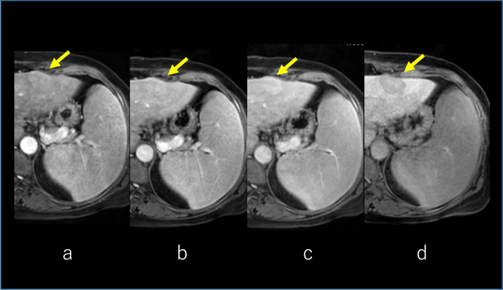 Fig 4