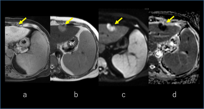 Fig 3