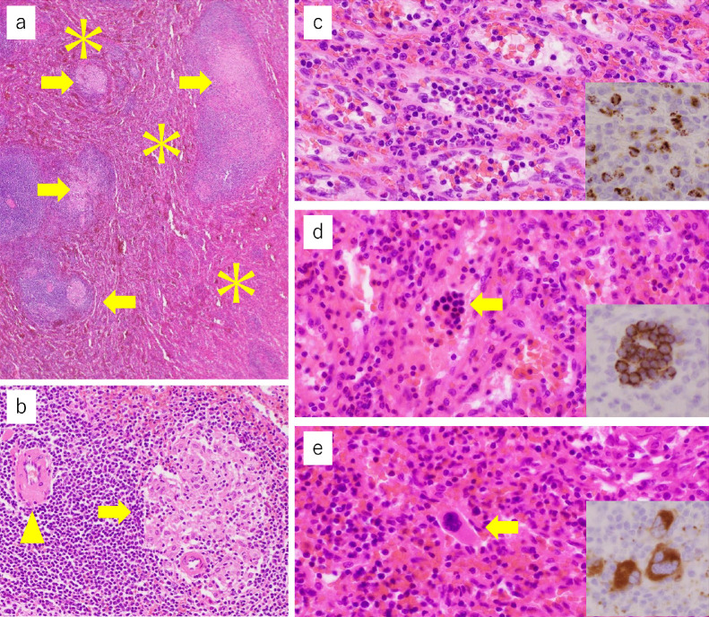 Fig 10