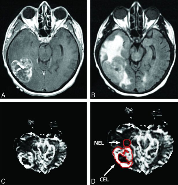 Fig 1.